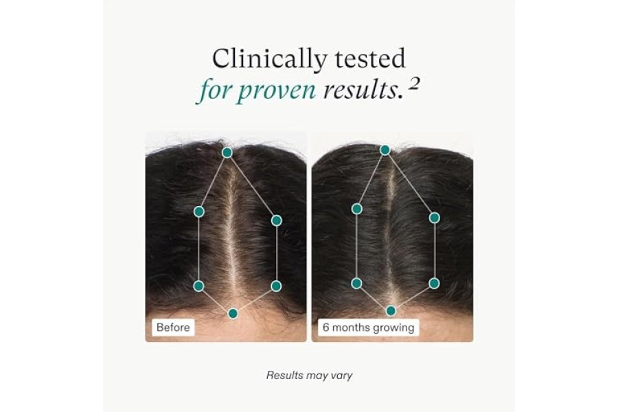 Suplementos para el crecimiento del cabello para mujeres Nutrafol, de 18 a 44 años, clínicamente probados para un cabello visiblemente más grueso y fuerte, recomendado por dermatólogos - Suministro para 1 mes - Image 4