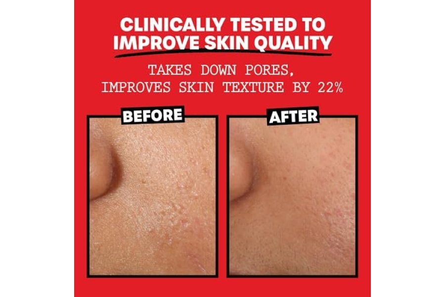 Thayers Tónico facial sin alcohol con pétalos de rosa y hamamelis para piel brillante, tónico calmante, hidratante y refrescante para piel normal y mixta, 12 oz - Image 5