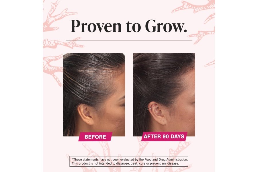 Suplementos para el crecimiento del cabello Viviscal para que las mujeres crezcan un cabello más grueso y lleno, clínicamente probado con complejo de colágeno patentado, 60 unidades (paquete de 1), suministro de 1 mes - Image 6